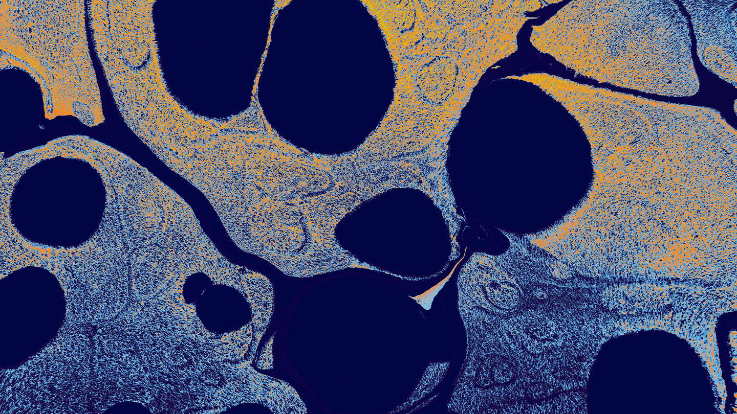 Microscopic view of cellular tissue for scientific research on Amyotrophic Lateral Sclerosis within Ferrer's neurological diseases area.