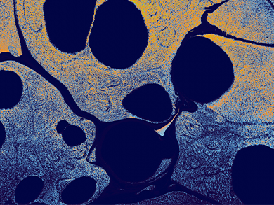 Vista microscópica de tejido celular para la investigación científica de la Esclerosis Lateral Amiotrófica dentro del área de enfermedades neurológicas de Ferrer.