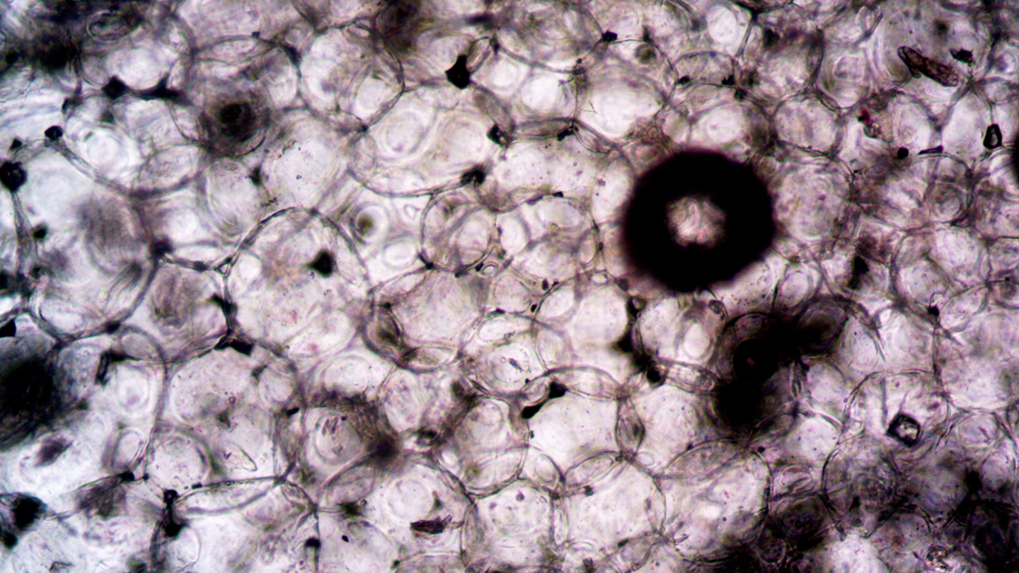 Muestra macroscópica de la estructura alveolar para el estudio y desarrollo de terapias contra la Hipertensión Pulmonar asociada a Enfermedad Pulmonar Intersticial en Ferrer.