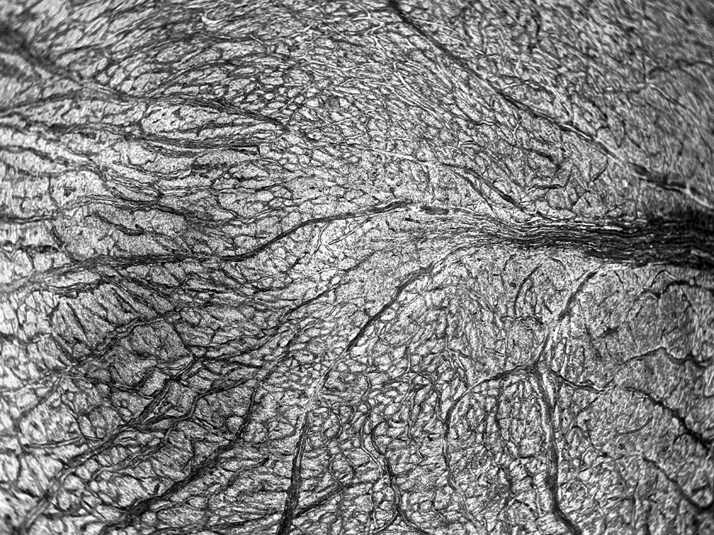 Concepto visual de rigidez arterial y resistencia en los vasos pulmonares, representativo de la investigación científica en Hipertensión Pulmonar por Ferrer.