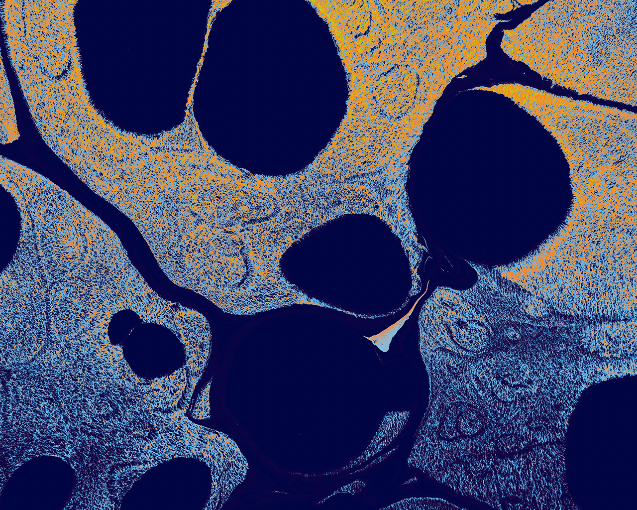 Vista microscópica de tejido celular para la investigación científica de la Esclerosis Lateral Amiotrófica dentro del área de enfermedades neurológicas de Ferrer.