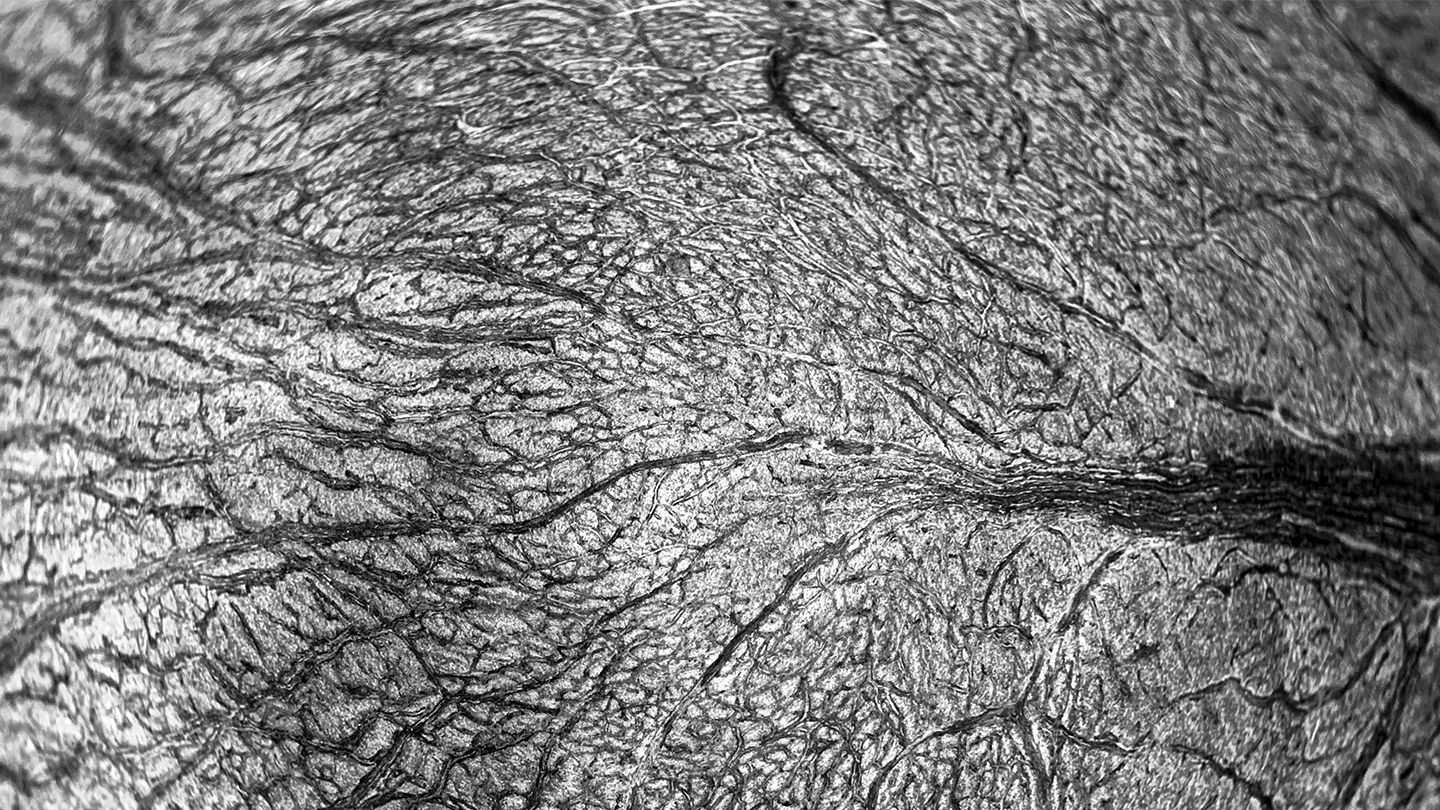 Concepto visual de rigidez arterial y resistencia en los vasos pulmonares, representativo de la investigación científica en Hipertensión Pulmonar por Ferrer.