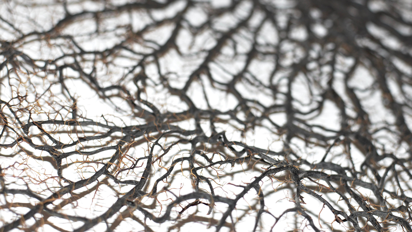 Mostra de teixit neuronal analitzada per a la recerca farmacològica de la Paràlisi Supranuclear Progressiva al pipeline de Ferrer.