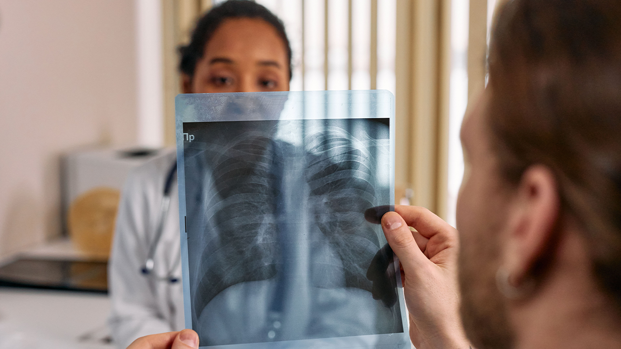 A patient holds a chest X-ray in front of a doctor who analyzes it in the office.