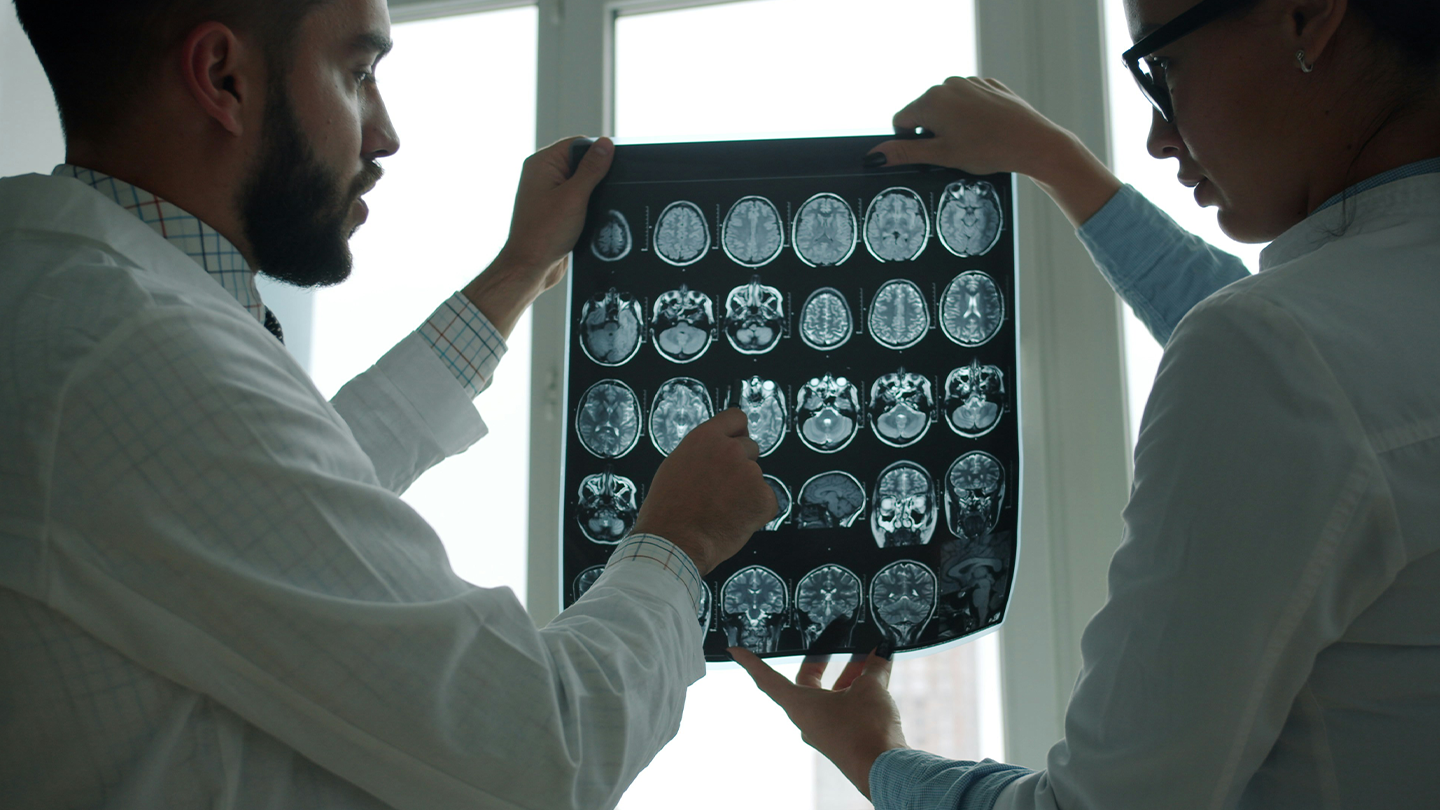 Resonancia magnética cerebral en un entorno clínico, vinculada a la investigación y desarrollo de tratamientos en el área de neurociencias de Ferrer.