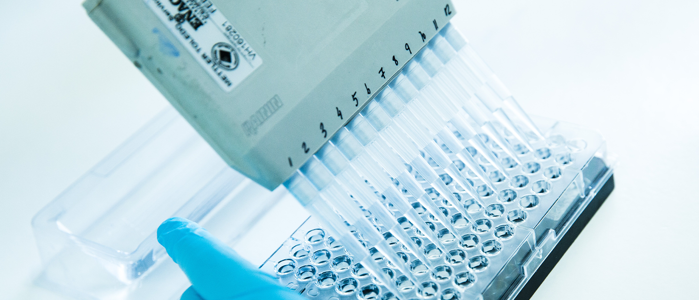 Procés de cribratge molecular amb pipeta multicanal per a la investigació de malalties en la farmacèutica de Ferrer.