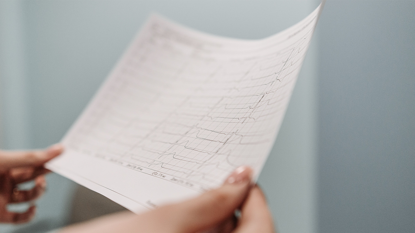 Un parell de mans sosté i examina de prop un full de paper amb els resultats impresos d'un electrocardiograma.