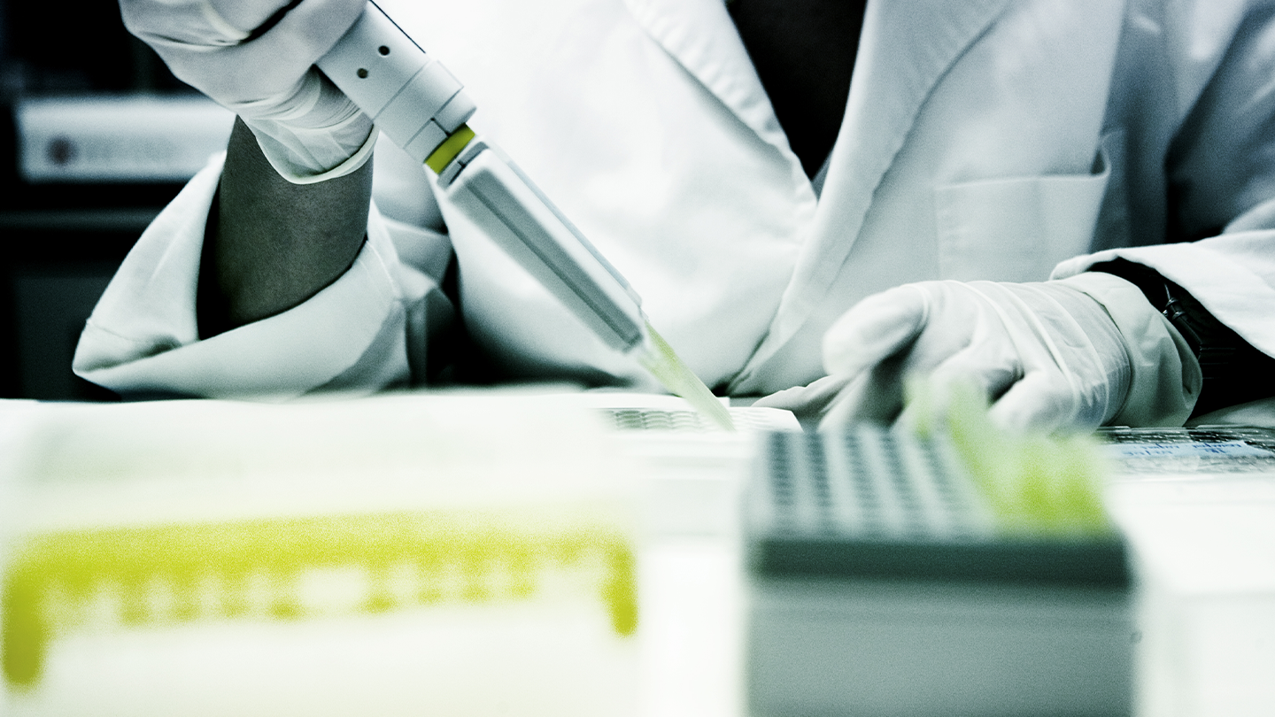 Resonancia magnética cerebral en un entorno clínico, vinculada a la investigación y desarrollo de tratamientos en el área de neurociencias de Ferrer.