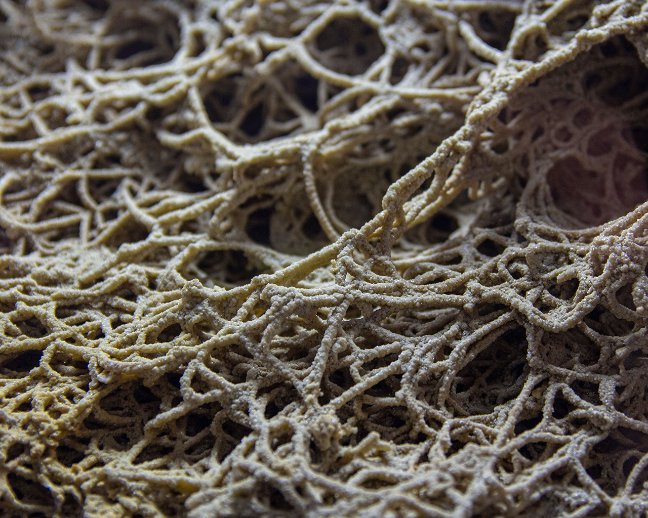 Anàlisi microscòpica de biomarcadors en teixit fibròtic pulmonar, clau en el desenvolupament de fàrmacs innovadors per a la Fibrosi Pulmonar Idiopàtica per Ferrer.